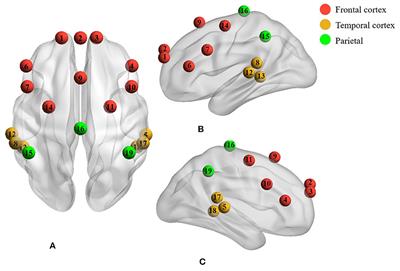 Evaluation of the Short-Term Music Therapy on Brain Functions of Preterm Infants Using Functional Near-Infrared Spectroscopy